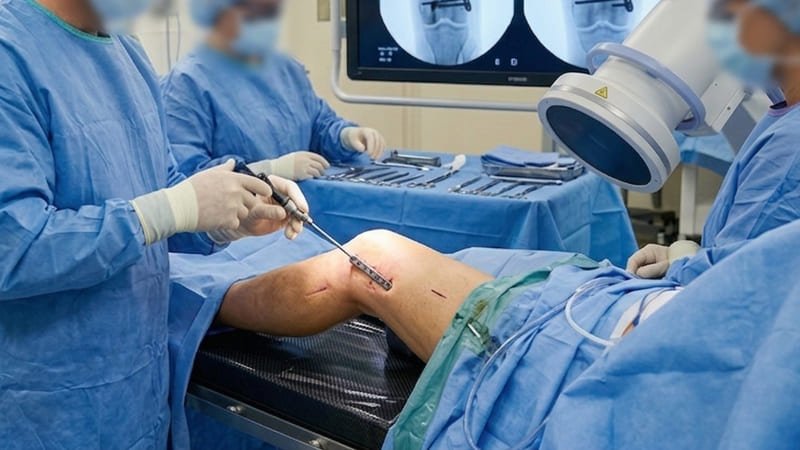 Minimally Invasive surgery for fractures - Dr Rajkumar