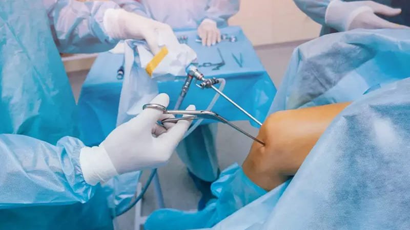 arthroscopic ACL reconstruction Dr Rajkumar