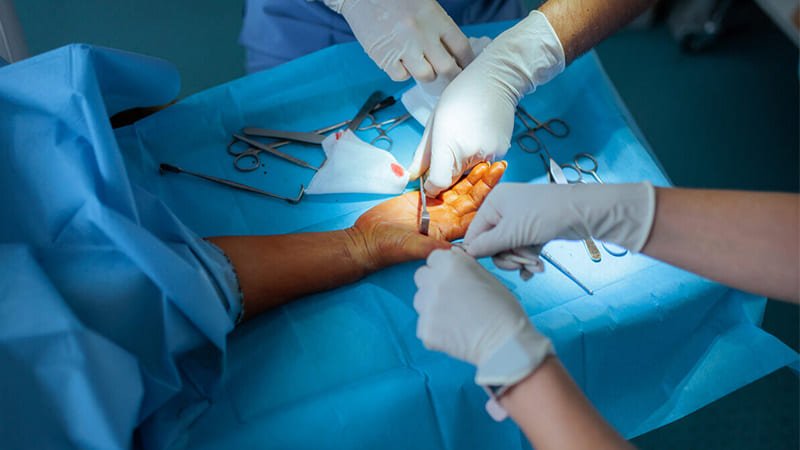 Hand Surgeon Dr Rajkumar